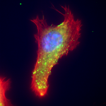 Epifluorescence image of extracellular vimentin