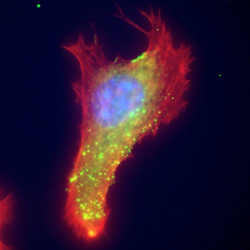 Epifluorescence image of extracellular vimentin