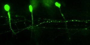 Spinal cord nerve cells labelled with green fluorescent protein. Photo Credit: Jose Juarez-Morales