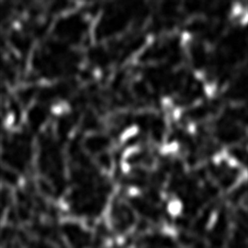Zeiss LSM980 with Airyscan2 live cell imaging of rat pancreatic beta cells (INS1- 832/13) transiently transfected with mEmerald-LifeAct.