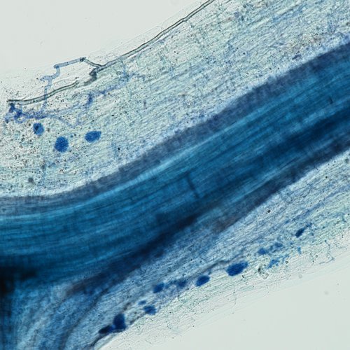 Arbuscular mycorrhizal fungi (dark blue spots) colonization in a poplar root.
