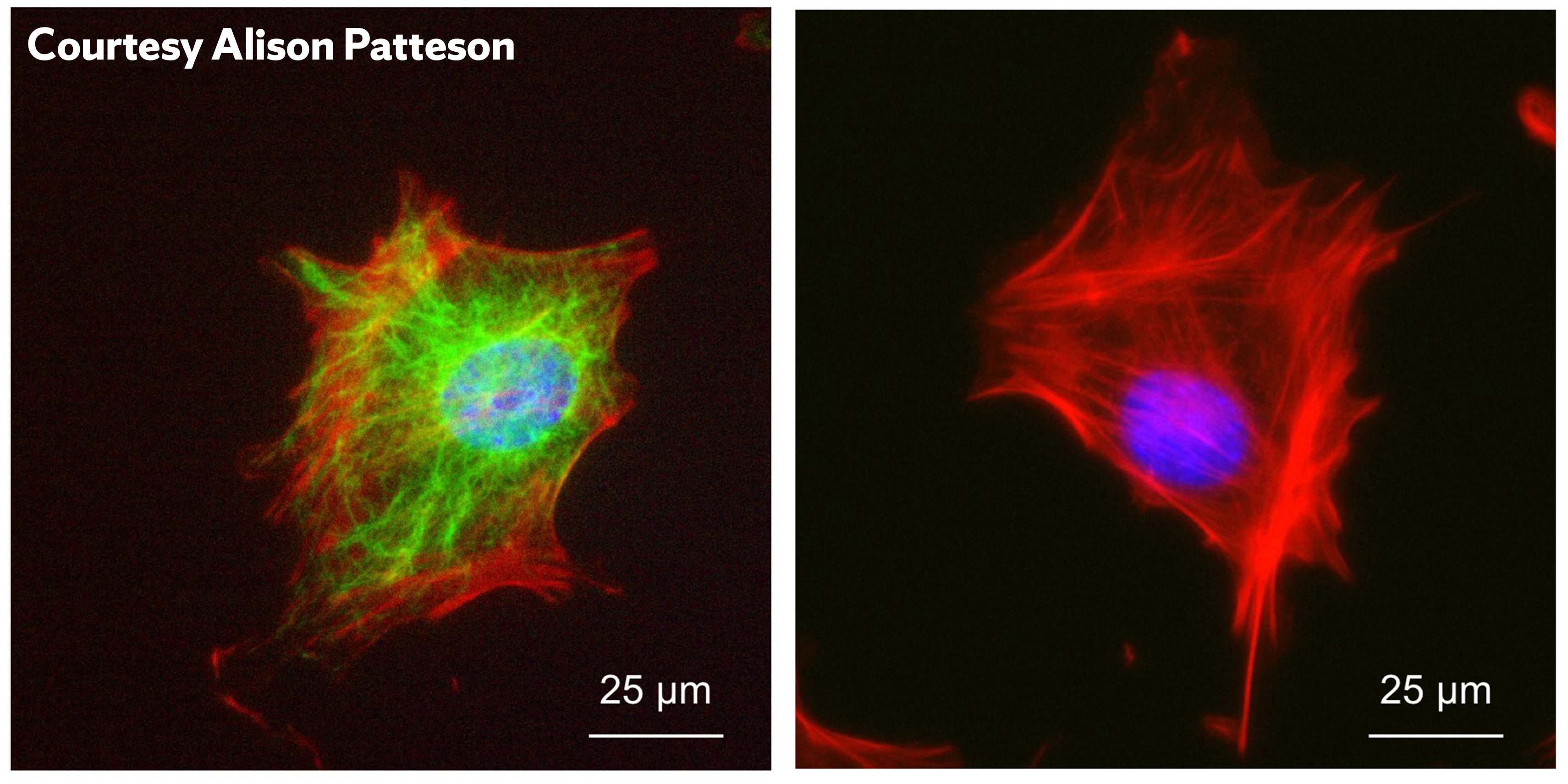 Cell with and without Vimentin intermediate filament