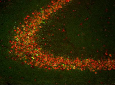 A photo showing the expression of COX-2 (green) and TIA-1 (red) in neurons. Syracuse researchers think TIA-1 suppresses epilepsy in the brain. (Courtesy of Elsevier)