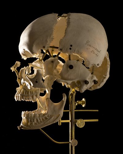Norman Barker, "Skull," 2012 (Courtesy of Syracuse University Art Galleries)
